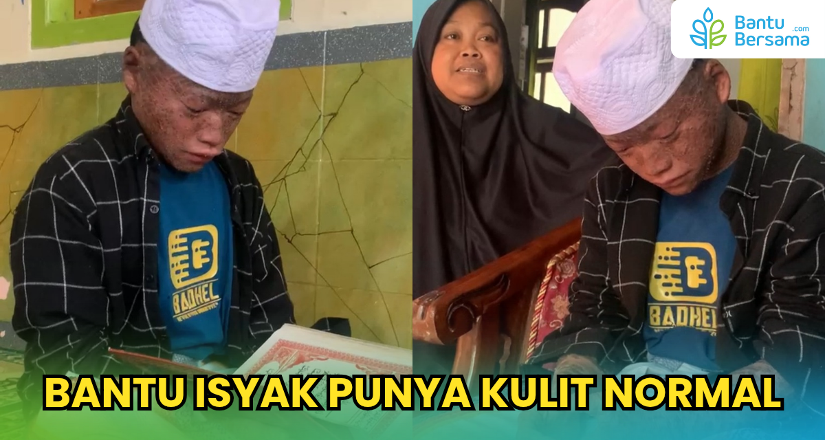 Bantu Isyak Punya Kulit Normal