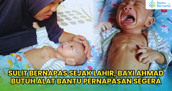 Sulit Bernapas Sejak Lahir, Bayi Ahmad Butuh Alat Bantu Pernapasan Segera
