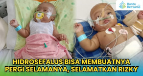 Hidrosefalus Bisa Membuatnya Pergi Selamanya, Selamatkan Rizky