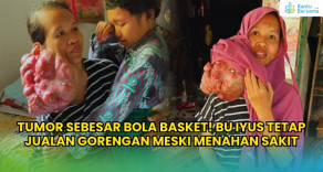 TUMOR SEBESAR BOLA BASKET! Bu Iyus Tetap Jualan Gorengan Meski Menahan Sakit